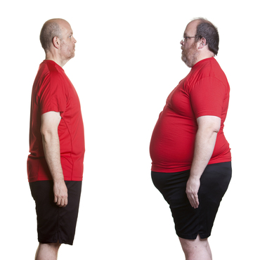 Journal of Diabetes Case Reports: Obesity Journal