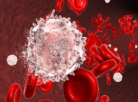 Journal of Hematology and Blood Cancer Case Reports